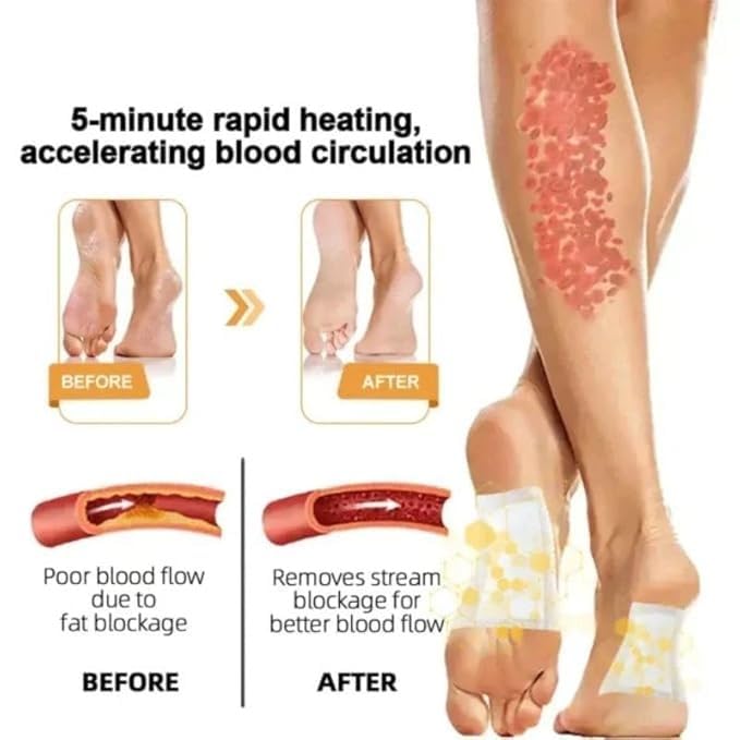 New Bee Venom Foot Patch Stress Relief Detox Patch Solution for Men & Women (BUY 1 GET 1 FREE  ) 🌿👣